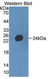 LAMB3 / Laminin Beta 3 Antibody - Western blot of LAMB3 / Laminin Beta 3 antibody.