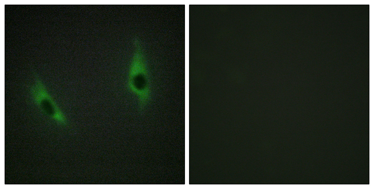 LAMB3 / Laminin Beta 3 Antibody - Immunofluorescence analysis of HeLa cells, using LAMB3 Antibody. The picture on the right is blocked with the synthesized peptide.