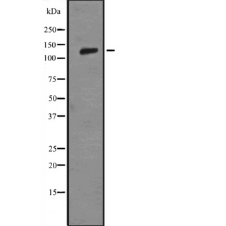 LAMB3 / Laminin Beta 3 Antibody - Western blot analysis of LAMB3 expression in HEK293 cells. The lane on the left is treated with the antigen-specific peptide.
