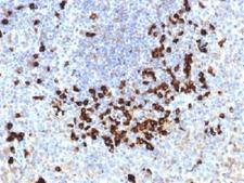 Lambda Light Chain Antibody - IHC testing of FFPE human tonsil stained with Lambda Light Chain antibody (clone LLC/1738). Required HIER: boil tissue sections in 10mM citrate buffer, pH 6, for 10-20 min.