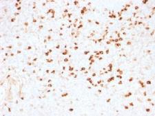 Lambda Light Chain Antibody - IHC testing of FFPE human tonsil stained with Lambda Light Chain antibody (clone N10/2). Required HIER: boil tissue sections in 10mM citrate buffer, pH 6, for 10-20 min.
