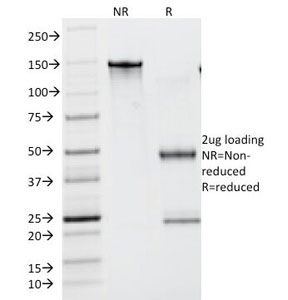 Lambda Light Chain Antibody - SDS-PAGE Analysis of Purified, BSA-Free Lambda Light Chain Antibody (clone N10/2). Confirmation of Integrity and Purity of the Antibody.