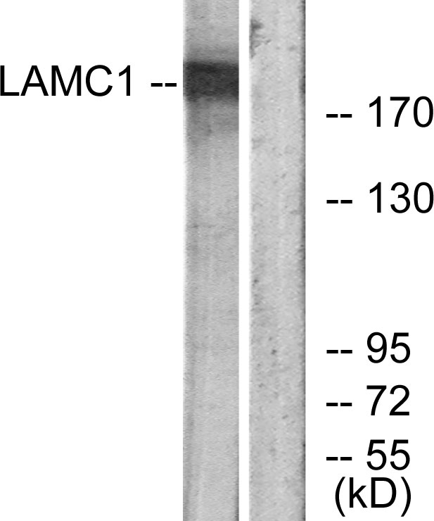LAMC1 / Laminin Gamma 1 Antibody - Western blot analysis of lysates from HUVEC cells, using LAMC1 Antibody. The lane on the right is blocked with the synthesized peptide.