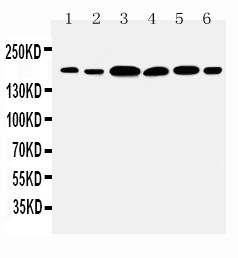 LAMC1 / Laminin Gamma 1 Antibody - WB of LAMC1 / Laminin Gamma 1 antibody. All lanes: Anti-LAMC1 at 0.5ug/ml. Lane 1: Rat Kidney Tissue Lysate at 40ug. Lane 2: Rat Lung Tissue Lysate at 40ug. Lane 3: U87 Whole Cell Lysate at 40ug. Lane 4: SMMC Whole Cell Lysate at 40ug. Lane 5: HELA Whole Cell Lysate at 40ug. Lane 6: SKOV1 Whole Cell Lysate at 40ug. Predicted bind size: 177KD. Observed bind size: 177KD.