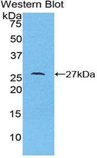 LAMC1 / Laminin Gamma 1 Antibody - Western blot of recombinant LAMC1 / Laminin Gamma 1.  This image was taken for the unconjugated form of this product. Other forms have not been tested.