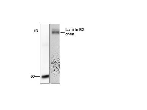 LAMC1 / Laminin Gamma 1 Antibody