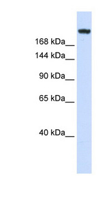 LAMC1 / Laminin Gamma 1 Antibody - LAMC1 / Laminin Gamma 1 antibody Western blot of Fetal Muscle lysate. This image was taken for the unconjugated form of this product. Other forms have not been tested.