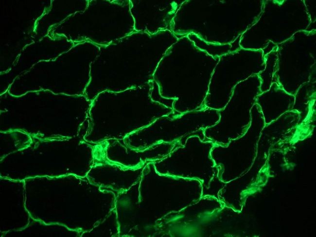 LAMC1 / Laminin Gamma 1 Antibody - Immunofluorescence staining of frozen sections from pig striated skeletal muscle (methanol fixed) using Laminin, showing the localization of laminin in the connective tissue and in basement membranes surrounding the myofibrils.
