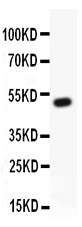 LAMC1 / Laminin Gamma 1 Antibody - Laminin antibody Western blot. All lanes: Anti Laminin at 0.5 ug/ml. WB: Recombinant Human Laminin Protein 0.5ng. Predicted band size: 50 kD. Observed band size: 50 kD.