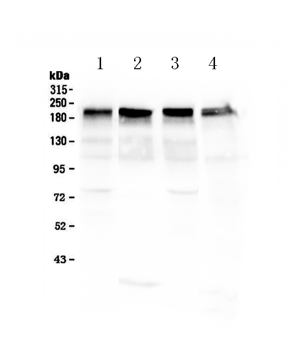 LAMC1 / Laminin Gamma 1 Antibody - Western blot analysis of Laminin using anti-Laminin antibody. Electrophoresis was performed on a 5-20% SDS-PAGE gel at 70V (Stacking gel) / 90V (Resolving gel) for 2-3 hours. The sample well of each lane was loaded with 50ug of sample under reducing conditions. Lane 1: mouse lung tissue lysate,Lane 2: rat cardiac muscle tissue lysate,Lane 3: rat lung tissue lysate,Lane 4: human Hela whole cell lysate. After Electrophoresis, proteins were transferred to a Nitrocellulose membrane at 150mA for 50-90 minutes. Blocked the membrane with 5% Non-fat Milk/ TBS for 1.5 hour at RT. The membrane was incubated with rabbit anti-Laminin antigen affinity purified polyclonal antibody at 0.5 µg/mL overnight at 4°C, then washed with TBS-0.1% Tween 3 times with 5 minutes each and probed with a goat anti-rabbit IgG-HRP secondary antibody at a dilution of 1:10000 for 1.5 hour at RT. The signal is developed using an Enhanced Chemiluminescent detection (ECL) kit with Tanon 5200 system. A specific band was detected for Laminin at approximately 200KD. The expected band size for Laminin is at 177KD.