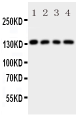 LAMC2 / Laminin Gamma 2 Antibody - Anti-LAMC2 antibody, Western blotting All lanes: Anti LAMC2 at 0.5ug/ml Lane 1: U87 Whole Cell Lysate at 40ug Lane 2: SMMC Whole Cell Lysate at 40ug Lane 3: HELA Whole Cell Lysate at 40ug Lane 4: SW620 Whole Cell Lysate at 40ug Predicted bind size: 131KD Observed bind size: 131KD
