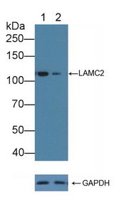 LAMC2 / Laminin Gamma 2 Antibody - Knockout Varification: Lane 1: Wild-type A431 cell lysate; Lane 2: LAMC2 knockout A431 cell lysate; Predicted MW: 121,130kd Observed MW: 120kd Primary Ab: 5µg/ml Rabbit Anti-Human LAMC2 Antibody Second Ab: 0.2µg/mL HRP-Linked Caprine Anti-Rabbit IgG Polyclonal Antibody