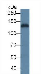 LAMC2 / Laminin Gamma 2 Antibody - Western Blot; Sample: Human A431 cell lysate; Primary Ab: 5µg/ml Rabbit Anti-Human LAMC2 Antibody Second Ab: 0.2µg/mL HRP-Linked Caprine Anti-Rabbit IgG Polyclonal Antibody