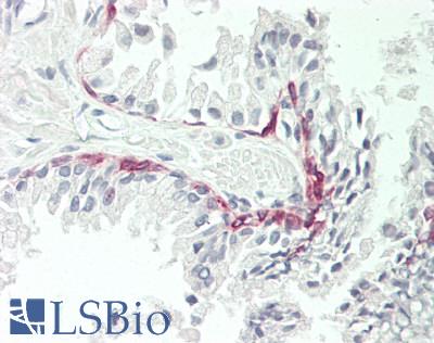 LAMC2 / Laminin Gamma 2 Antibody - Human Prostate: Formalin-Fixed, Paraffin-Embedded (FFPE)