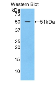 LAMC2 / Laminin Gamma 2 Antibody - Western blot of recombinant LAMC2 / Laminin Gamma 2.  This image was taken for the unconjugated form of this product. Other forms have not been tested.