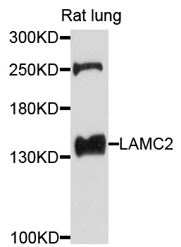 LAMC2 / Laminin Gamma 2 Antibody - Western blot analysis of extracts of rat lung cells.