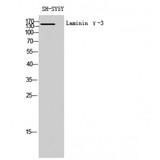 LAMC3 / Laminin Gamma 3 Antibody - Western blot of Laminin gamma-3 antibody