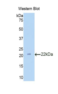 LAMC3 / Laminin Gamma 3 Antibody - Western blot of recombinant LAMC3 / Laminin Gamma 3.  This image was taken for the unconjugated form of this product. Other forms have not been tested.