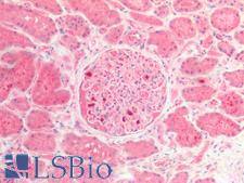 LAMC3 / Laminin Gamma 3 Antibody - Human Kidney: Formalin-Fixed, Paraffin-Embedded (FFPE)