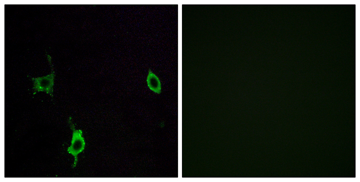 LAMC3 / Laminin Gamma 3 Antibody - Immunofluorescence analysis of LOVO cells, using LAMC3 Antibody. The picture on the right is blocked with the synthesized peptide.