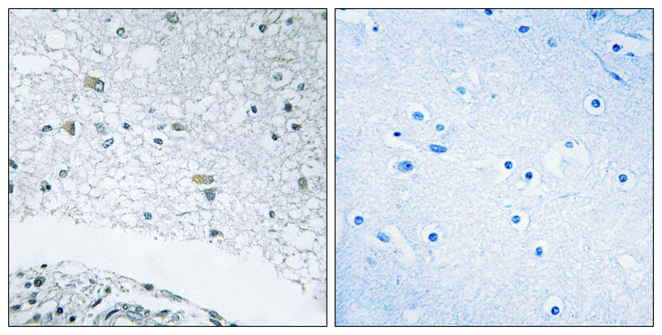 LAMC3 / Laminin Gamma 3 Antibody - Immunohistochemistry analysis of paraffin-embedded human brain tissue, using LAMC3 Antibody. The picture on the right is blocked with the synthesized peptide.