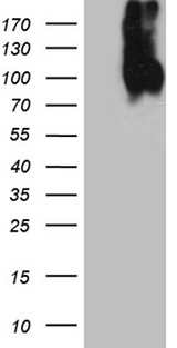LAMP1 / CD107a Antibody - HEK293T cells were transfected with the pCMV6-ENTRY control. (Left lane) or pCMV6-ENTRY LAMP1. (Right lane) cDNA for 48 hrs and lysed
