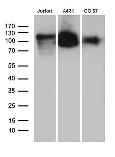 LAMP1 / CD107a Antibody - Western blot analysis of extracts. (35ug) from 3 cell lines by using anti-LAMP1 monoclonal antibody. (1:500)