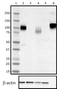 LAMP1 / CD107a Antibody - Western blot of purified anti-LAMP-1 antibody (clone H4A3). Lane 1: Molecular weight marker; Lane 2: 20 µg of Hela cell lysate; Lane 3: 20 µg of NIH3T3 cell lysate; Lane 4: 20 µg of human brain lysate; Lane 5: 20 µg of mouse brain lysate; Lane 6: 10 ng of human recombinant LAMP-1. The blot was incubated with 1 µg/ml of the primary antibody overnight at 4°C, followed by incubation with HRP-labeled goat anti-mouse IgG. Anti-ß-actin antibody was used as the loading control. Enhanced chemiluminescence was used as the detection system.
