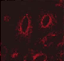 LAMP1 / CD107a Antibody - Immunofluorescent detection of LAMP 1 in transfected HeLa cells