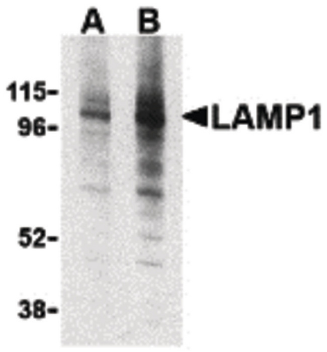 LAMP1 / CD107a Antibody - Western blot of LAMP-1 in EL4 cell lysate with LAMP-1 antibody at (A) 1 and (B) 2 ug/ml.