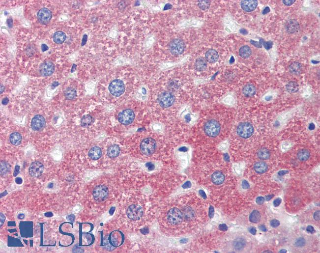 LAMP1 / CD107a Antibody - Anti-LAMP1 antibody IHC of mouse liver. Immunohistochemistry of formalin-fixed, paraffin-embedded tissue after heat-induced antigen retrieval. Antibody concentration 5 ug/ml.