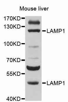LAMP1 / CD107a Antibody - Western blot analysis of extracts of mouse liver, using LAMP1 antibody at 1:500 dilution. The secondary antibody used was an HRP Goat Anti-Rabbit IgG (H+L) at 1:10000 dilution. Lysates were loaded 25ug per lane and 3% nonfat dry milk in TBST was used for blocking. An ECL Kit was used for detection and the exposure time was 30s.