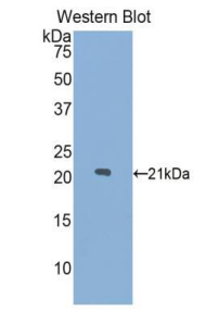 LAMP2 / CD107b Antibody - Western blot of recombinant LAMP2 / CD107b.  This image was taken for the unconjugated form of this product. Other forms have not been tested.