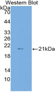 LAMP2 / CD107b Antibody - Western blot of recombinant LAMP2 / CD107b.  This image was taken for the unconjugated form of this product. Other forms have not been tested.