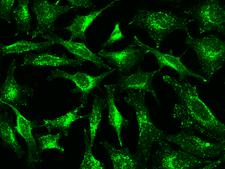 LAMP2 / CD107b Antibody - Immunofluorescence staining of LAMP2 in Hela cells. Cells were fixed with 4% PFA, permeabilzed with 0.1% Triton X-100 in PBS, blocked with 10% serum, and incubated with mouse anti-human LAMP2 monoclonal antibody (dilution ratio 1:60) at 4°C overnight. Then cells were stained with the Alexa Fluor 488-conjugated Goat Anti-mouse IgG secondary antibody (green). Positive staining was localized to Cytoplasm.