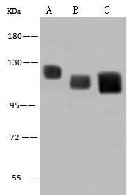 LAMP2 / CD107b Antibody - Anti-LAMP2 mouse monoclonal antibody at 1:500 dilution. Lane A: HepG2 Whole Cell Lysate. Lane B: Jurkat Whole Cell Lysate. Lane C: Hela Whole Cell Lysate. Lysates/proteins at 30 ug per lane. Secondary: Goat Anti-Mouse IgG (H+L)/HRP at 1/10000 dilution. Developed using the ECL technique. Performed under reducing conditions. Predicted band size: 45 kDa.