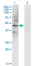 LAMP2 / CD107b Antibody - Western Blot analysis of LAMP2 expression in transfected 293T cell line by LAMP2 monoclonal antibody (M01), clone 2G10.Lane 1: LAMP2 transfected lysate (Predicted MW: 45 KDa).Lane 2: Non-transfected lysate.
