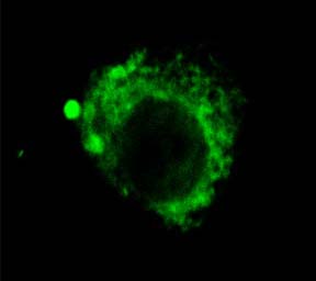 LAMP2 / CD107b Antibody - Distribution of lysosomes in circulating endothelial cells (CEC)