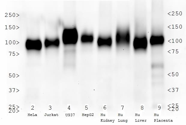 LAMP2 / CD107b Antibody - Western Blot: LAMP2 Antibody (H4B4) - Analysis of LAMP2 expression in HeLa, Jurkat, U937, HepG2 whole cell lysates, human kidney, lung, liver and placenta tissue extracts.  This image was taken for the unconjugated form of this product. Other forms have not been tested.