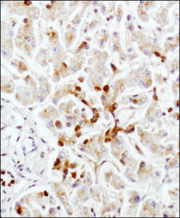LAMP2 / CD107b Antibody - Immunohistochemistry-Paraffin: LAMP2 Antibody (H4B4) - IHC staining of LAMP2 in human liver using DAB with hematoxylin counterstain.  This image was taken for the unconjugated form of this product. Other forms have not been tested.