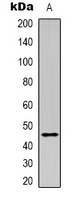 LAMP2 / CD107b Antibody - Western blot analysis of CD107b expression in HEK293T (A) whole cell lysates.