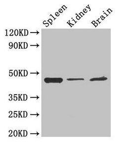 LAMP2 / CD107b Antibody - Western Blot Positive WB detected in: Mouse spleen, Mouse kidney, Mouse brain All lanes: LAMP2 antibody at 4µg/ml Secondary Goat polyclonal to rabbit IgG at 1/50000 dilution Predicted band size: 45, 46 kDa Observed band size: 45 kDa