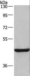 LAMP2 / CD107b Antibody - Western blot analysis of Human placenta tissue, using LAMP2 Polyclonal Antibody at dilution of 1:500.