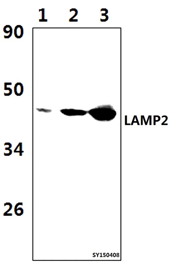 LAMP2 / CD107b Antibody - Western blot of LAMP2 antibody at 1:1000 dilution. Lane 1: A549 whole cell lysate (57ug). Lane 2: The Lung tissue lysate of Rat (39ug). Lane 3: The Lung tissue lysate of Mouse (39ug).