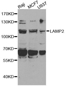 LAMP2 / CD107b Antibody - Western blot analysis of extracts of various cell lines, using LAMP2 antibody at 1:1000 dilution. The secondary antibody used was an HRP Goat Anti-Rabbit IgG (H+L) at 1:10000 dilution. Lysates were loaded 25ug per lane and 3% nonfat dry milk in TBST was used for blocking. An ECL Kit was used for detection.