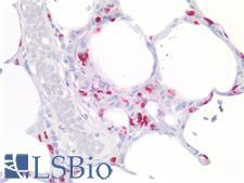 LAMP3 / CD208 Antibody - Human Lung, Type 2 Pneumocytes: Formalin-Fixed, Paraffin-Embedded (FFPE)