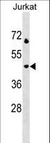 LAMP3 / CD208 Antibody - LAMP3 Antibody western blot of Jurkat cell line lysates (35 ug/lane). The LAMP3 antibody detected the LAMP3 protein (arrow).