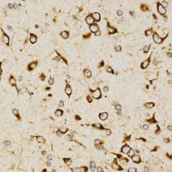 LAMP3 / CD208 Antibody - Immunohistochemistry of paraffin-embedded rat brain tissue.