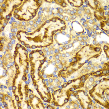 LAMP3 / CD208 Antibody - Immunohistochemistry of paraffin-embedded Rat kidney tissue.