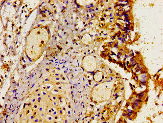 LAMP3 / CD208 Antibody - Immunohistochemistry image of paraffin-embedded human lung tissue at a dilution of 1:100